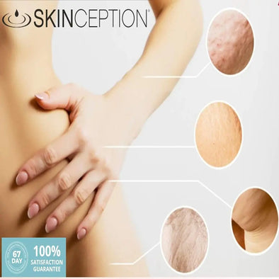 The Optimal Stretch Mark Cream For 2021? - Our Overview Of Skinception. Platinum Delux ®