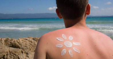 Why men are more susceptible to sunburn than ladies Platinum Delux ®